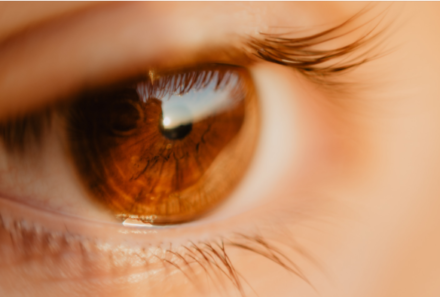Rode ogen – moet je naar de dokter of niet?