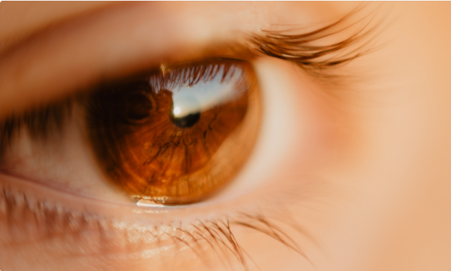 Rode ogen – moet je naar de dokter of niet?